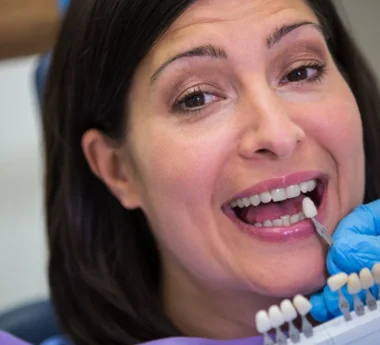 When Should You Get a Dental Crown?