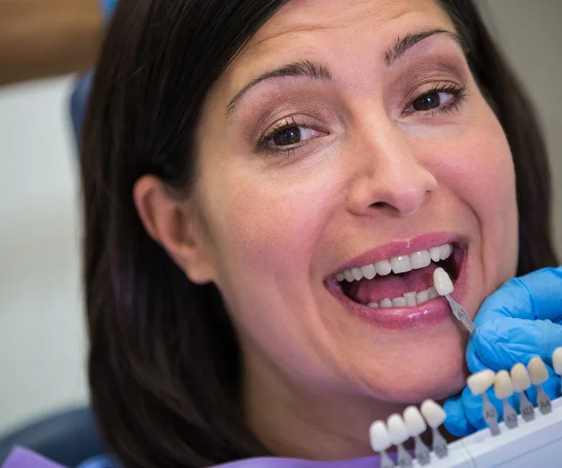 When Should You Get a Dental Crown?