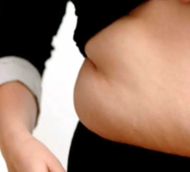 Understanding Cushing Syndrome: Causes, Symptoms, and Treatment Options