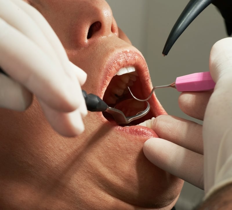 Fundamentals of Periodontal Instrumentation in Modern Dental Practice